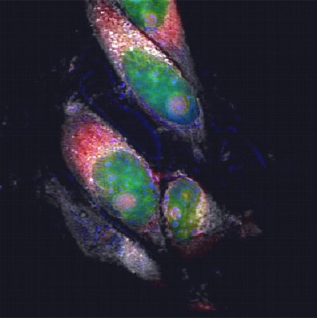 Мультимодальное CARS/TPEF изображение растущих клеток рака
